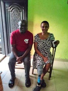 Cross River woman's leg amputated over diabetic complications